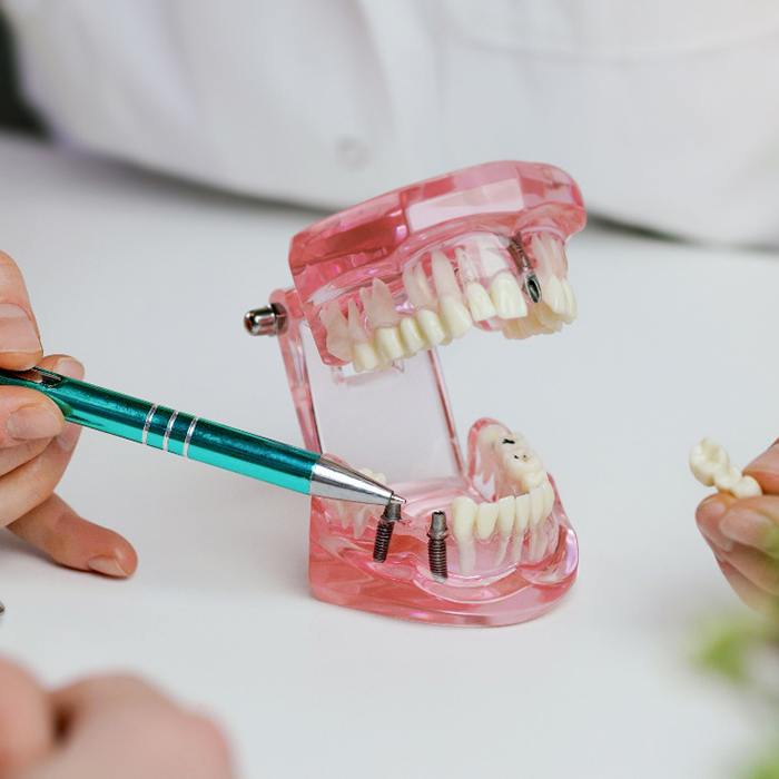 A dentist showing an implant bridge